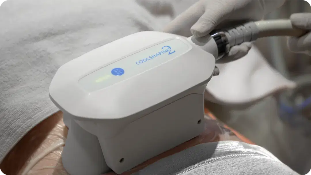 Cryolipolysis: Metode Non-invasif Mengatasi Lemak Tubuh