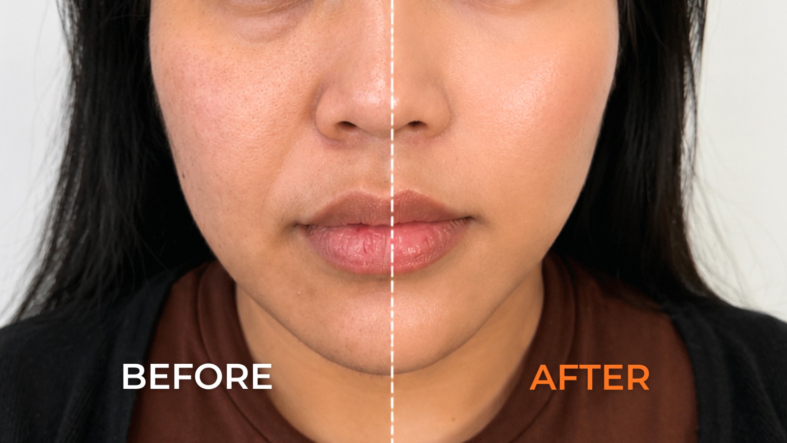 5 Signs Your Skin Is Losing Elasticity and How to Prevent It