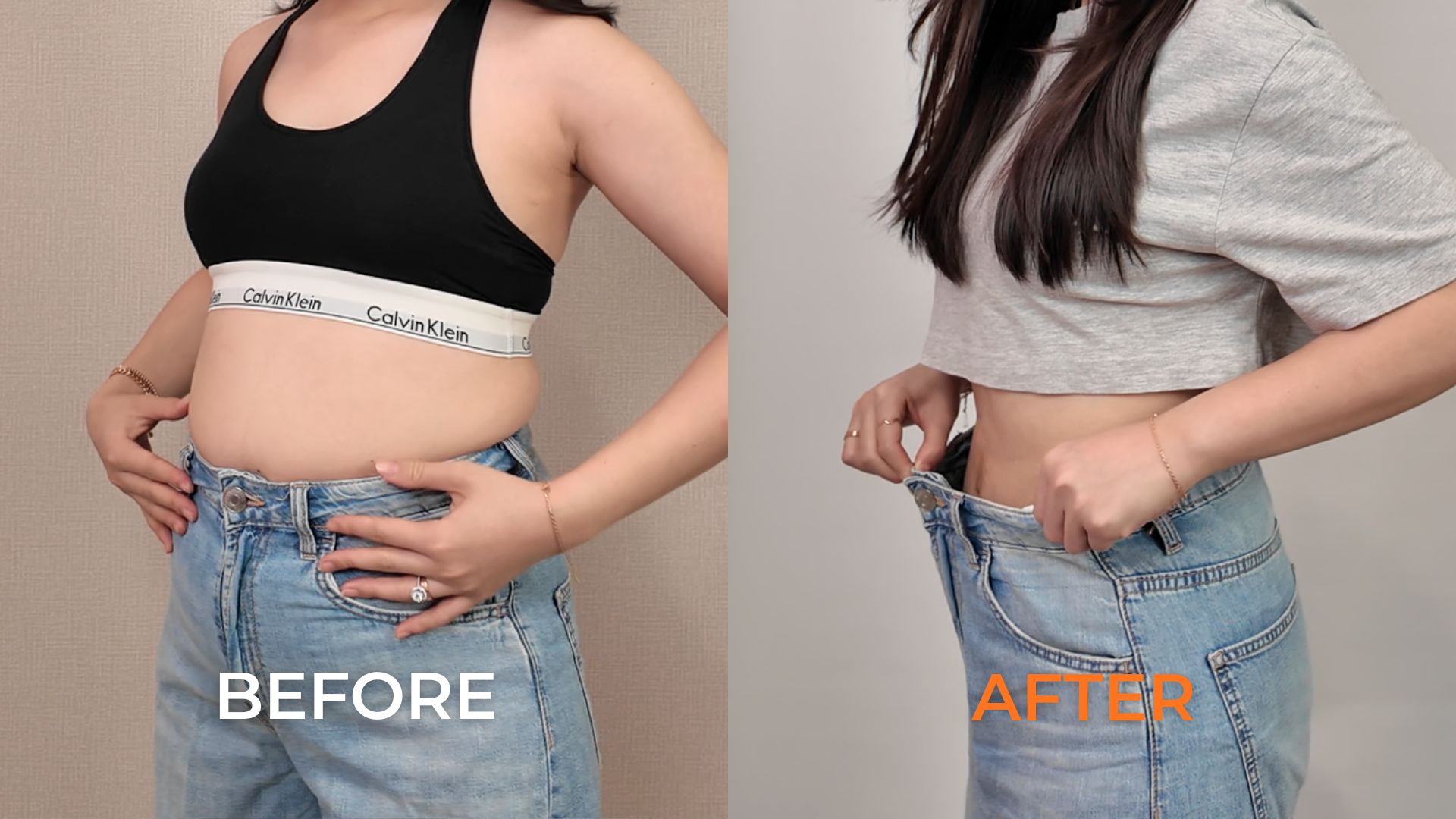 Mommy Makeover Pasca Hamil & Melahirkan