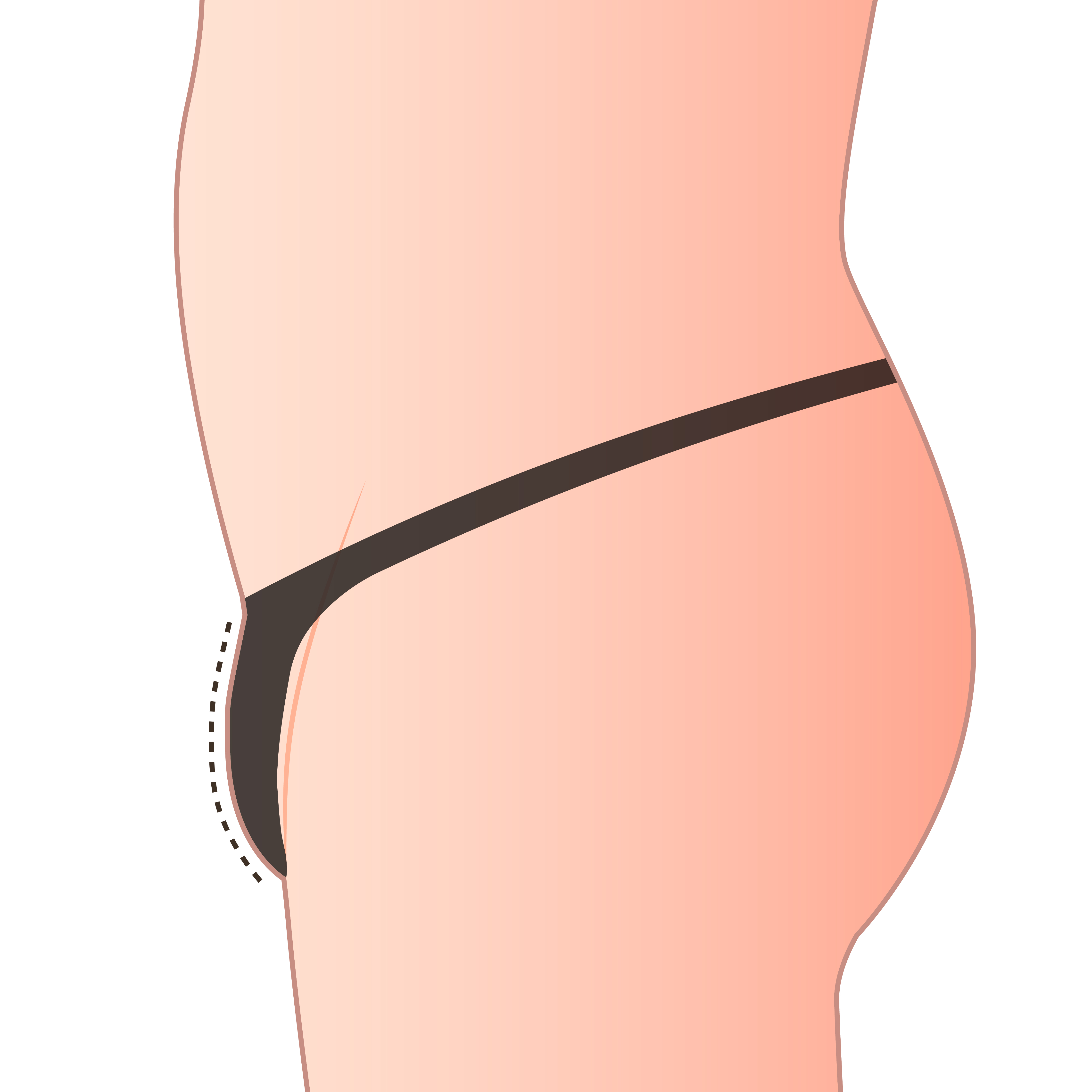 Sebelum LAMS Mons Pubis