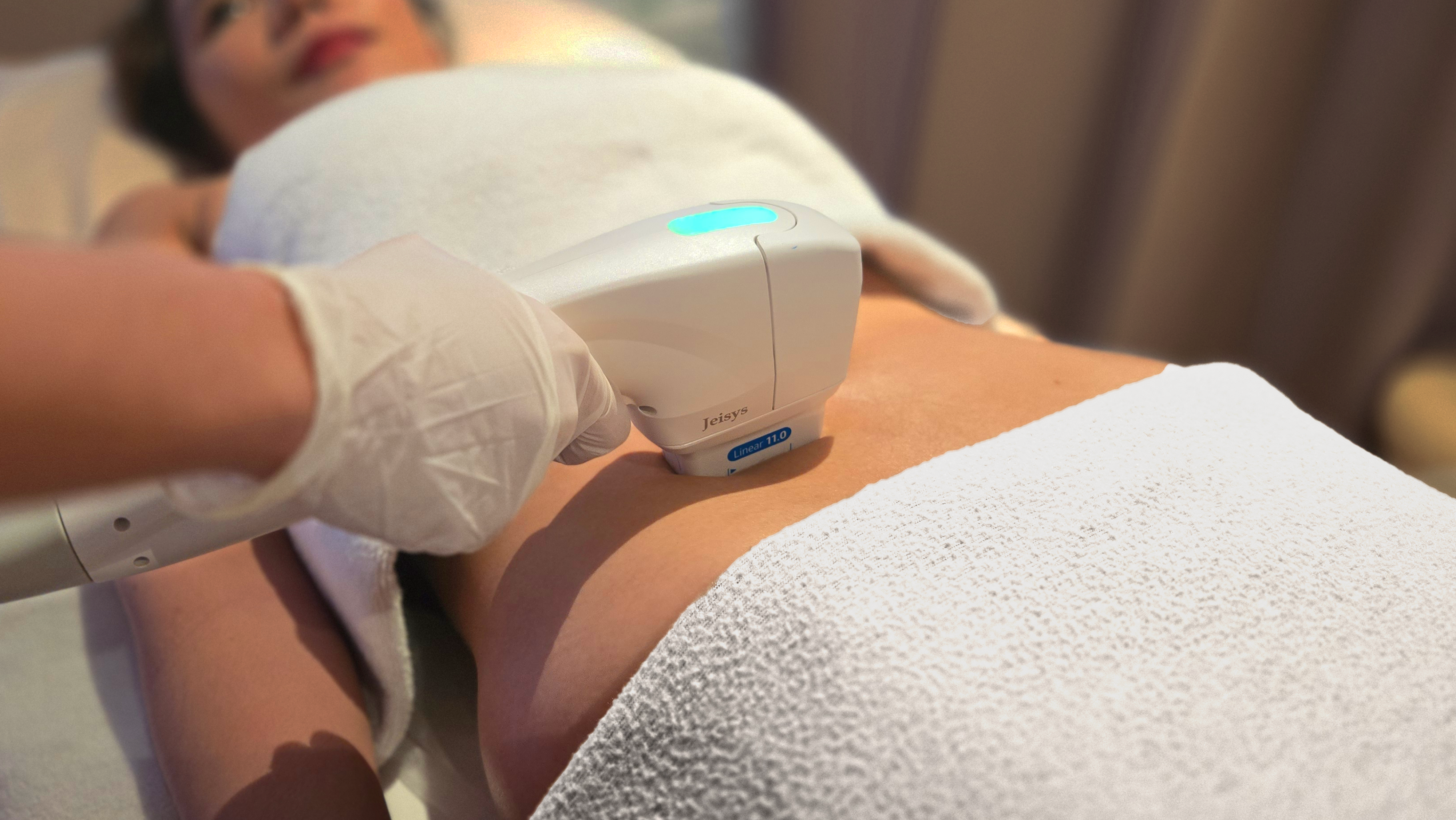 Korean S-Line Treatment treatment at akasia 365mc